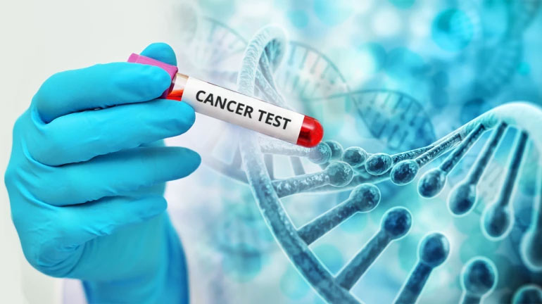 آیا با آزمایش ژنتیک میتوان از سرطان جلوگیری کرد؟